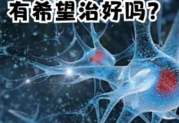 精神衰弱症是什么意思(精神衰弱症是什么病)