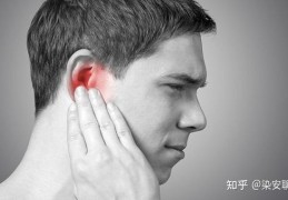 间歇性耳鸣是什么意思啊(间歇性耳鸣是什么原因)