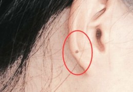 神仙下凡投胎的5颗痣(神仙下凡投胎的5颗痣图)