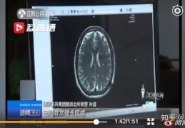 后天精神病遗传几率有多大(后天精神病遗传几率是多少)