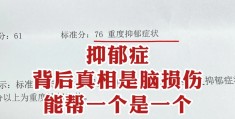 医生能不能看出假装抑郁(一图看懂真假抑郁症)