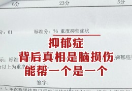 医生能不能看出假装抑郁(一图看懂真假抑郁症)