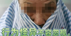 患有精神疾病的症状表现(患有精神疾病的症状表现是什么)